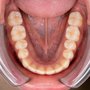 Lower dental arch